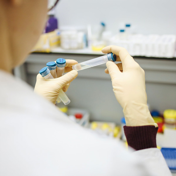 Services Up Renova : Analyse en laboratoire des champignons